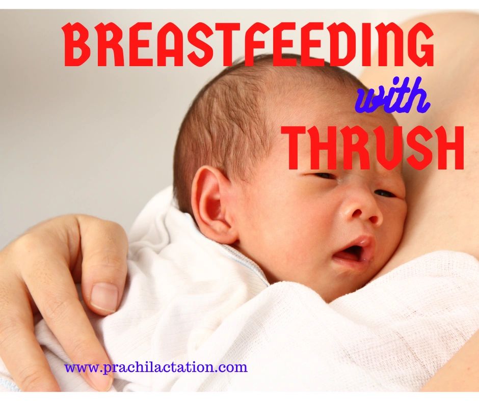 6 Tips for breastfeeding during Thrush infection